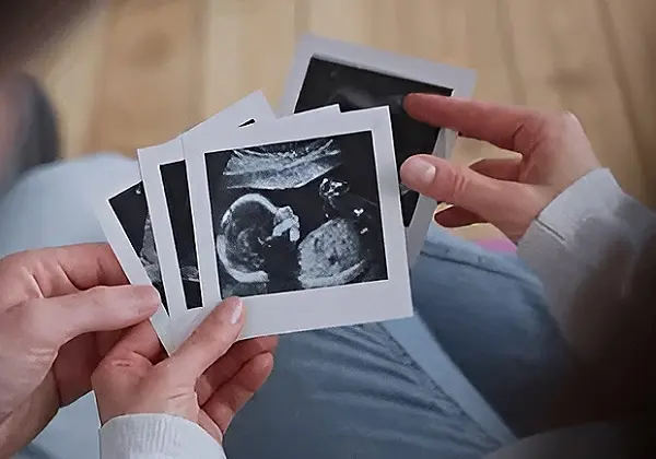 Pobačaj je vodeći uzrok smrti u svijetu